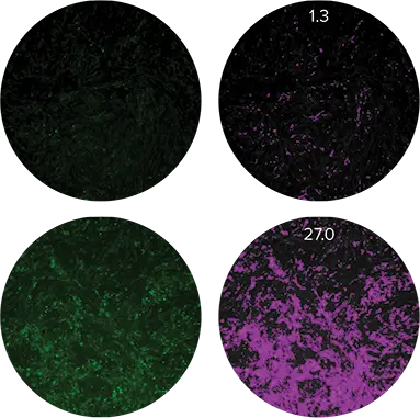 図2. 抗炎症性化合物による治療に対する細胞の反応。左の画像は蛍光イメージャーVCAM-1を発現している細胞を示し、右の紫色のマスクは炎症マーカーを示す細胞のセグメンテーションを示している。高用量の抗炎症化合物SB202で処理したセル（上段）はVCAM-1をほとんど発現していないが、非常に低用量のSB202で処理したセル（下段）はサイトカインで刺激され、大量のVCAM-1を発現した。値は正規化した総シグナル強度で示した。
